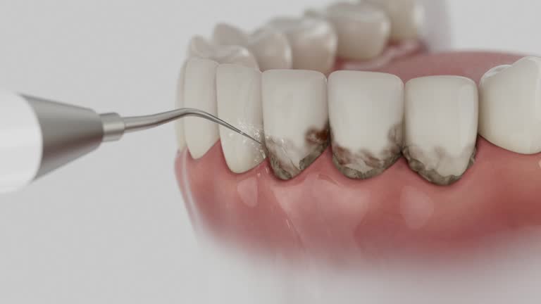 Reliable Dental Implants contractor in Belfair, WA by Smile Center Dentistry